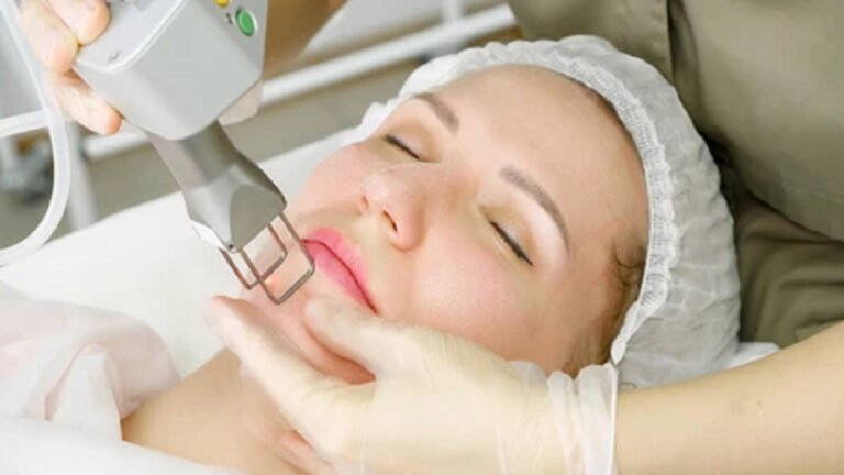 Will Pigmentation Come Back After Laser Treatment