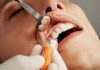 The Science Behind Dental Implants: What You Need to Know Before Your Procedure