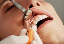 The Science Behind Dental Implants: What You Need to Know Before Your Procedure